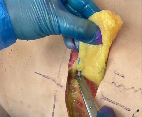 Perforator flap pre-course