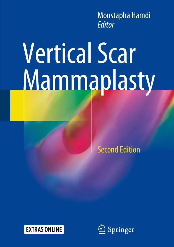  Vertical Scar Mammaplasty 
